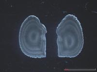 Otolithes de plie (Pleuronectes platessa)